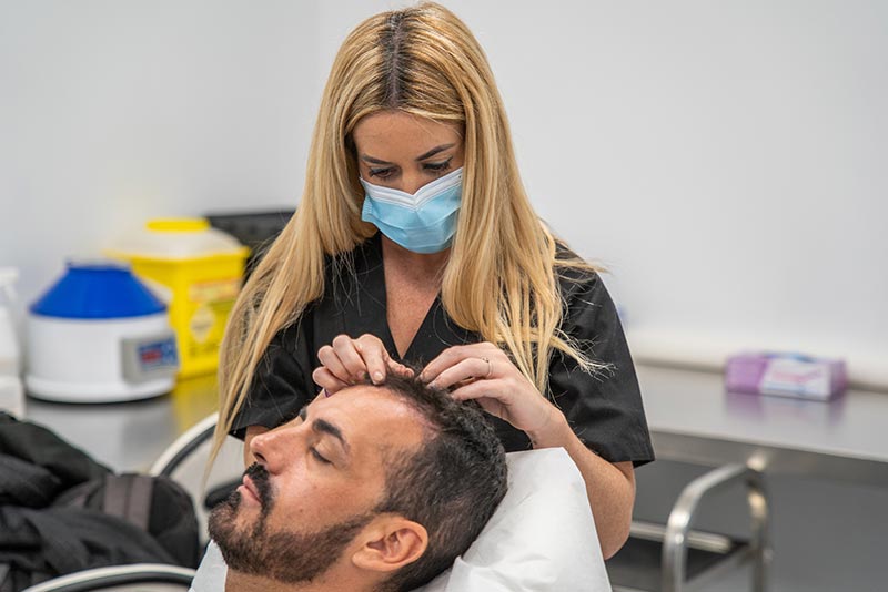 injerto capilar en cordoba españa